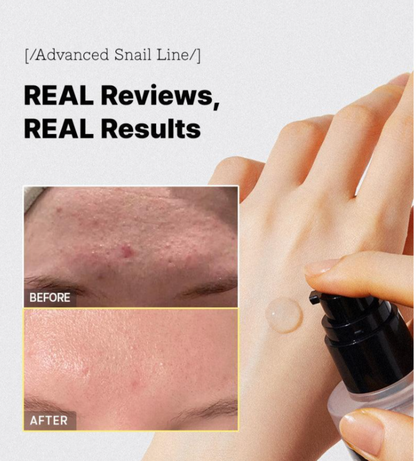 COSRX Advanced Snail 96 Mucin Power Essence 100ml